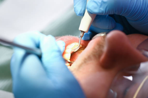Best Emergency Dentist for Lost Fillings or Crowns in River Oaks, TX