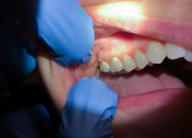 Best Holiday Emergency Dentist in River Oaks, TX